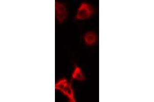 ABIN6268891 staining LOVO by IF/ICC. (FAP antibody  (Internal Region))
