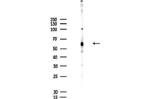 Western blot analysis of lysates from HepG2 cells(LPS,4h treatment), using DMR Antibody at 1/1000 dilution.