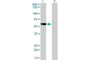 Western Blotting (WB) image for anti-Target of Myb 1 (TOM1) (AA 394-492) antibody (ABIN599110) (TOM1 antibody  (AA 394-492))