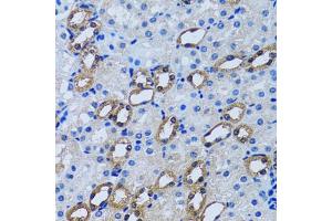 Immunohistochemistry of paraffin-embedded rat kidney using IMPA1 antibody (ABIN2563424) at dilution of 1:100 (40x lens). (IMPA1 antibody)