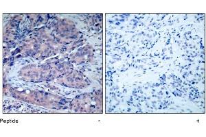 Image no. 1 for anti-Mitogen-Activated Protein Kinase Kinase 4 (MAP2K4) (Thr261) antibody (ABIN197322)