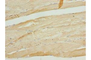 Immunohistochemistry of paraffin-embedded human skeletal muscle tissue using ABIN7173467 at dilution of 1:100 (TRIM55 antibody  (AA 101-300))