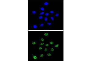 Confocal immunofluorescent analysis of DKC1 Antibody (Center) (ABIN651670 and ABIN2840353) with 293 cell followed by Alexa Fluor® 488-conjugated goat anti-rabbit lgG (green). (DKC1 antibody  (AA 185-213))