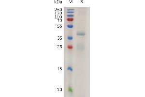 Human R(21-263) Protein, His Tag on SDS-PAGE under reducing condition. (RSPO1 Protein (AA 21-263) (His tag))