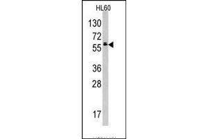 Image no. 1 for anti-Testis-Specific Kinase 2 (TESK2) (Middle Region) antibody (ABIN360162) (TESK2 antibody  (Middle Region))