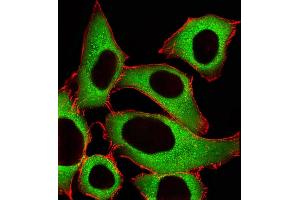 Fluorescent image of A549 cells stained with ALDH1A1 Antibody (Center) (ABIN1945086 and ABIN2838551). (ALDH1A1 antibody  (AA 306-339))