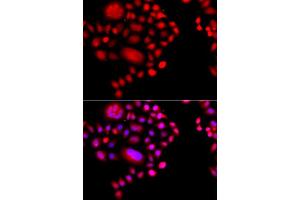 Immunofluorescence analysis of A549 cells using POLR1D antibody (ABIN5974951). (POLR1D antibody)