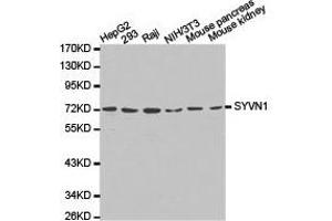 Western Blotting (WB) image for anti-Synovial Apoptosis Inhibitor 1, Synoviolin (SYVN1) antibody (ABIN1875011) (SYVN1 antibody)