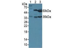 Western blot analysis of (1) Mouse Sp2/0 Cells, (2) Mouse Liver Tissue and (3) Mouse Pancreas Tissue. (LRG1 antibody  (AA 136-342))