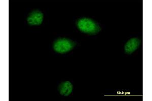 Immunofluorescence of purified MaxPab antibody to BAT3 on HeLa cell. (BAT3 antibody  (AA 1-1126))