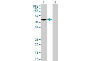 Lane 1: KIAA0409 transfected lysate ( 50. (KIAA0409 293T Cell Transient Overexpression Lysate(Denatured))