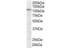 Image no. 1 for anti-Squamous Cell Carcinoma Antigen Recognized By T Cells (SART1) (N-Term) antibody (ABIN374288) (SART1 antibody  (N-Term))