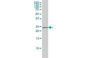 CRADD monoclonal antibody (M01), clone 1F8 Western Blot analysis of CRADD expression in K-562 . (CRADD antibody  (AA 1-199))