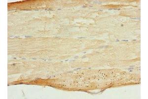Immunohistochemistry of paraffin-embedded human skeletal muscle tissue using ABIN7160608 at dilution of 1:100 (MYBPC2 antibody  (AA 912-1141))