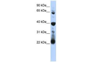 RPUSD3 antibody used at 1 ug/ml to detect target protein. (RPUSD3 antibody  (Middle Region))