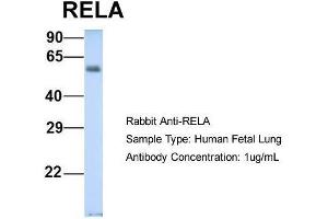 Western Blotting (WB) image for anti-Nuclear Factor-kB p65 (NFkBP65) (Middle Region) antibody (ABIN2779331)