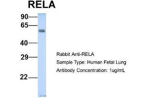Host: Rabbit  Target Name: RELA  Sample Tissue: Human Fetal Lung  Antibody Dilution: 1. (NF-kB p65 antibody  (Middle Region))