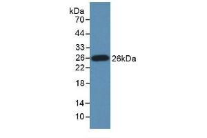 Detection of Recombinant GRIP1, Human using Monoclonal Antibody to Glutamate Receptor Interacting Protein 1 (GRIP1) (GRIP1 antibody  (AA 874-1073))