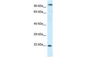 Image no. 1 for anti-Polymerase (RNA) III (DNA Directed) Polypeptide G (32kD)-Like (POLR3GL) (C-Term) antibody (ABIN6747444) (POLR3GL antibody  (C-Term))