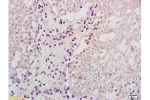 Formalin-fixed and paraffin embedded rat testis labeled with Rabbit Anti ELL2 Polyclonal Antibody, Unconjugated (ABIN1387852) at 1:200 followed by conjugation to the secondary antibody and DAB staining (ELL2 antibody  (AA 561-640))