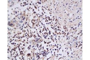 Immunohistochemistry (Paraffin-embedded Sections) (IHC (p)) image for anti-Nuclear Apoptosis Inducing Factor 1 (NAIF1) (AA 3-85) antibody (ABIN668796) (NAIF1 antibody  (AA 3-85))