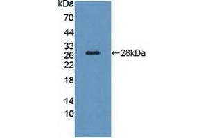 Detection of Recombinant TSHR, Rat using Polyclonal Antibody to Thyroid Stimulating Hormone Receptor (TSHR) (TSH receptor antibody  (AA 28-245))