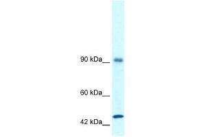 WB Suggested Anti-RBM10 Antibody Titration: 1. (RBM10 antibody  (N-Term))