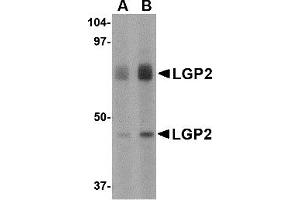 Western Blotting (WB) image for anti-DEXH (Asp-Glu-X-His) Box Polypeptide 58 (DHX58) (Middle Region) antibody (ABIN1030985) (DHX58 antibody  (Middle Region))