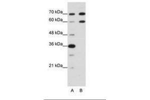 Image no. 2 for anti-Doublesex and Mab-3 Related Transcription Factor 2 (DMRT2) (N-Term) antibody (ABIN203207) (DMRT2 antibody  (N-Term))