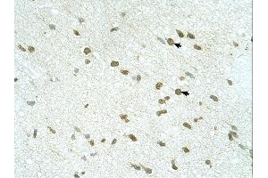 RNF168 antibody was used for immunohistochemistry at a concentration of 4-8 ug/ml. (RNF168 antibody  (C-Term))