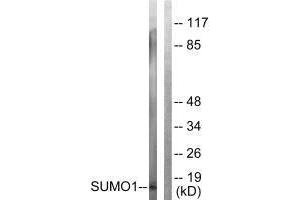 Western blot analysis of extracts from 293 cells, using Sumo1 antibody. (SUMO1 antibody  (N-Term))