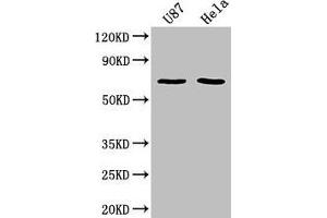 Western Blot Positive WB detected in: U87 whole cell lysate, Hela whole cell lysate All lanes: SUSD5 antibody at 1:2000 Secondary Goat polyclonal to rabbit IgG at 1/50000 dilution Predicted band size: 69 kDa Observed band size: 69 kDa
