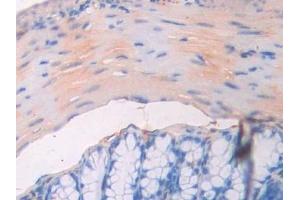 Immunohistochemistry (IHC) image for anti-CD34 (CD34) (AA 36-287) antibody (ABIN7434413)