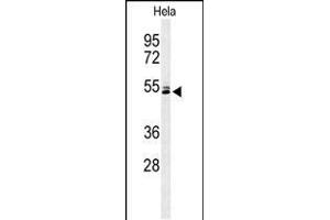 Western blot analysis of K2C78 Antibody (Center) (ABIN653813 and ABIN2843087) in Hela cell line lysates (35 μg/lane).
