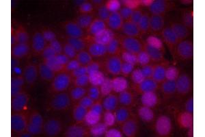 Immunofluorescence staining of methanol-fixed MCF cells using Phospho-ESR1-S106 antibody.