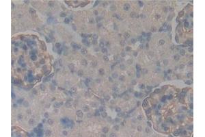 Detection of PODXL in Rat Kidney Tissue using Polyclonal Antibody to Podocalyxin (PODXL) (PODXL antibody  (AA 153-386))