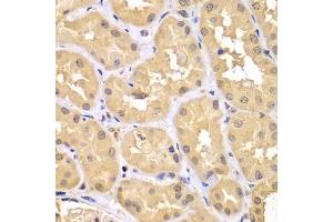 Immunohistochemistry of paraffin-embedded human kidney using TRIM69 antibody (ABIN7270998) at dilution of 1:100 (40x lens). (TRIM69 antibody  (AA 1-341))