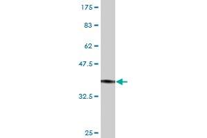 Western Blot detection against Immunogen (37. (VIPR2 antibody  (AA 24-126))