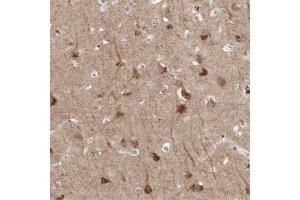 Immunohistochemical staining of human cerebral cortex with TNFRSF11A polyclonal antibody  shows strong cytoplasmic positivity in neurons at 1:500-1:1000 dilution.