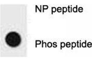 Dot blot analysis of p-ERBB2 antibody. (ErbB2/Her2 antibody  (pTyr1196))