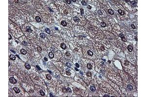 Immunohistochemistry (IHC) image for anti-alpha-Fetoprotein (AFP) (AA 19-397) antibody (ABIN2716010) (alpha Fetoprotein antibody  (AA 19-397))