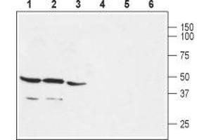 Western blot analysis of rat brain (lanes 1 and 4), mouse brain (lanes 2 and 5) and rat lung (lanes 3 and 6) membranes: - 1-3. (GPER antibody  (C-Term, Intracellular))