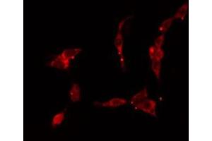 ABIN6277157 staining HuvEc cells by IF/ICC. (KRT17 antibody  (C-Term))
