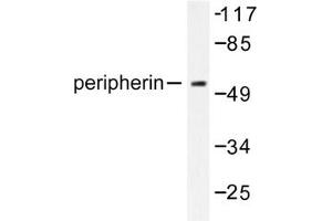 Image no. 1 for anti-Peripherin (PRPH) antibody (ABIN271783) (Peripherin antibody)