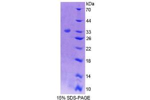 SDS-PAGE (SDS) image for Protein tyrosine Phosphatase, Non-Receptor Type 5 (Striatum-Enriched) (PTPN5) (AA 270-533) protein (His tag) (ABIN6239266) (PTPN5 Protein (AA 270-533) (His tag))