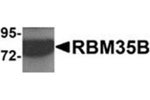 Western blot analysis of RBM35B in human lung tissue lysate with RBM35B antibody at 1 μg/ml. (ESRP2 antibody  (C-Term))