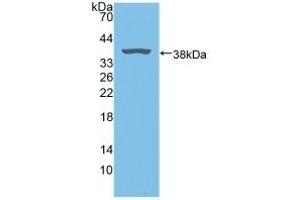 Detection of Recombinant BLVRA, Rat using Polyclonal Antibody to Biliverdin Reductase A (BLVRA) (Biliverdin Reductase antibody  (AA 10-279))