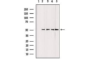 Western blot analysis of extracts from various samples, using GCSc-γ Antibody.