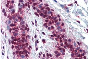 Human Breast: Formalin-Fixed, Paraffin-Embedded (FFPE) (CREB1 antibody  (AA 1-96))