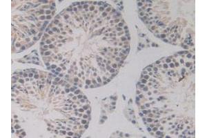 Detection of BMP15 in Mouse Testis Tissue using Polyclonal Antibody to Bone Morphogenetic Protein 15 (BMP15) (BMP15 antibody  (AA 274-390))